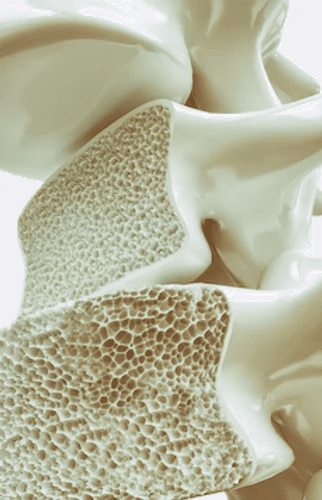 Improved bone density from osteoporosis and osteopenia